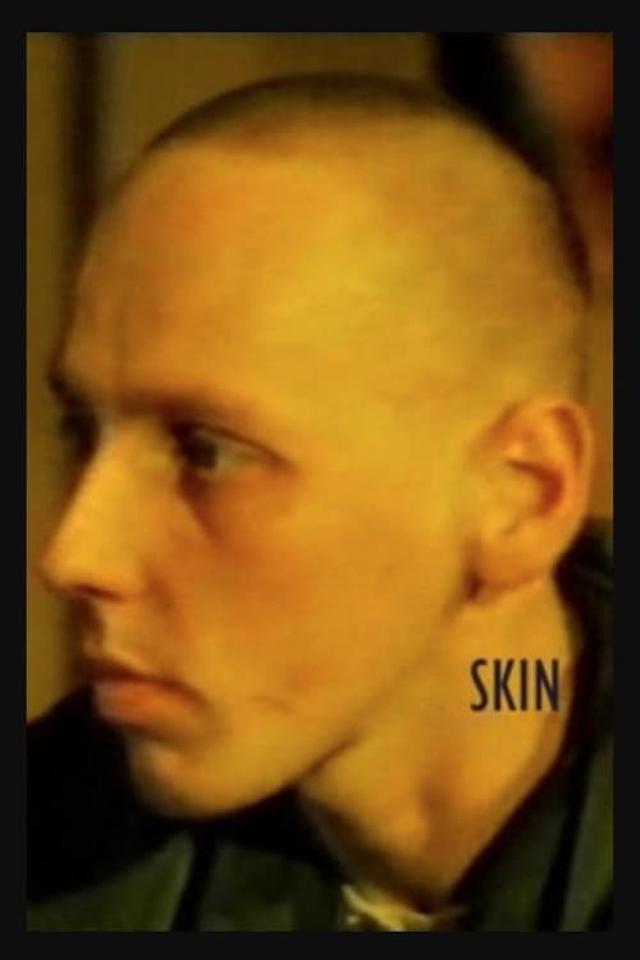 Skin